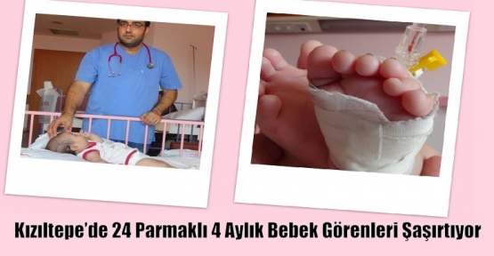 Kızıltepe’de 24 Parmaklı 4 Aylık Bebek Görenleri Şaşırtıyor
