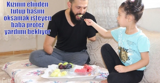 Kızının elinden tutup başını okşamak isteyen baba protez yardımı bekliyor 