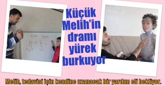 Küçük Melih’in dramı yürek burkuyor